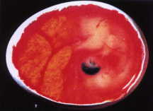 Embryo nach 10 Tagen Bebrtung