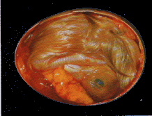 Embryo nach 20 Tagen Bebrtung